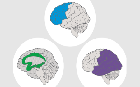 UDL Brain Networks, from CAST